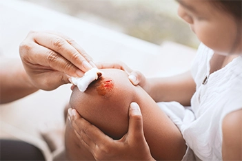 Teenage girl receiving wound care treatment from a healthcare professional.