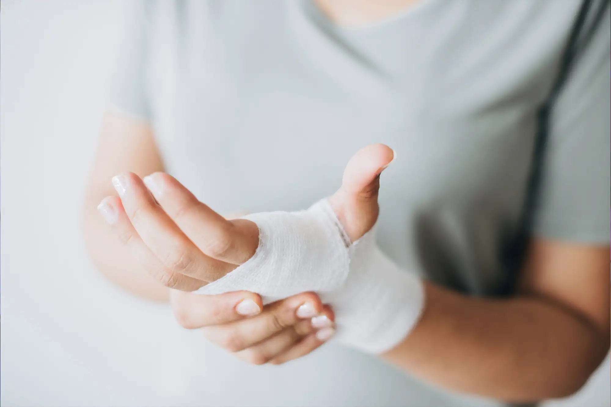 Child patient with a wrapped hand following treatment for a minor hand fracture.