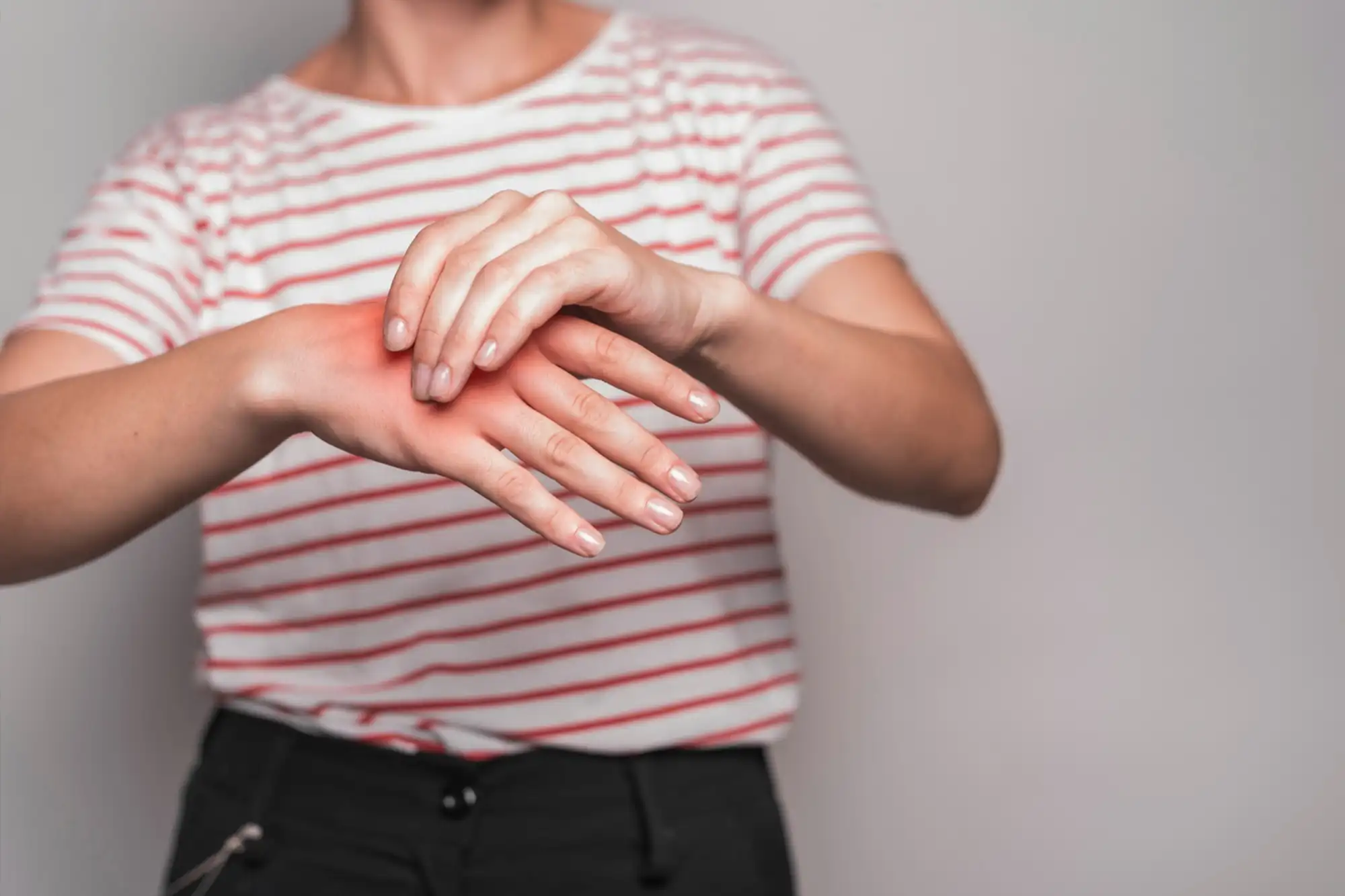 Child receiving treatment for swollen hand caused by thermal burns and scalds.